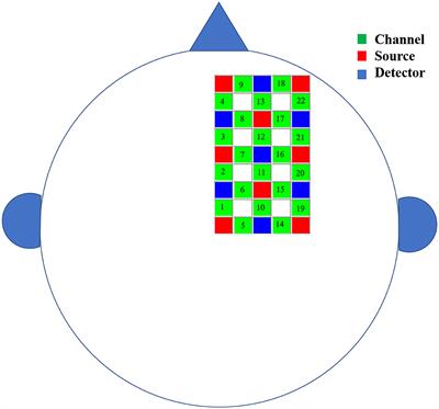 Recombination of the right cerebral cortex in patients with left side USN after stroke: fNIRS evidence from resting state